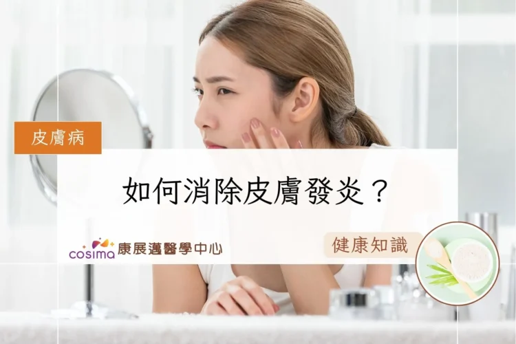 如何消除皮膚發炎