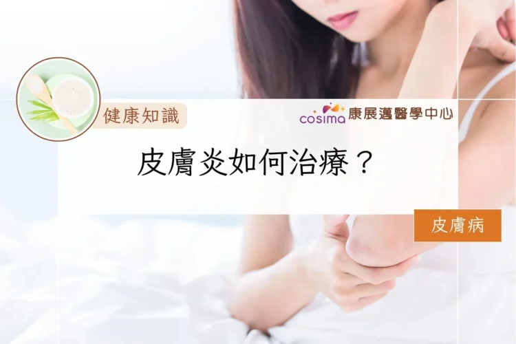 皮膚炎如何治療