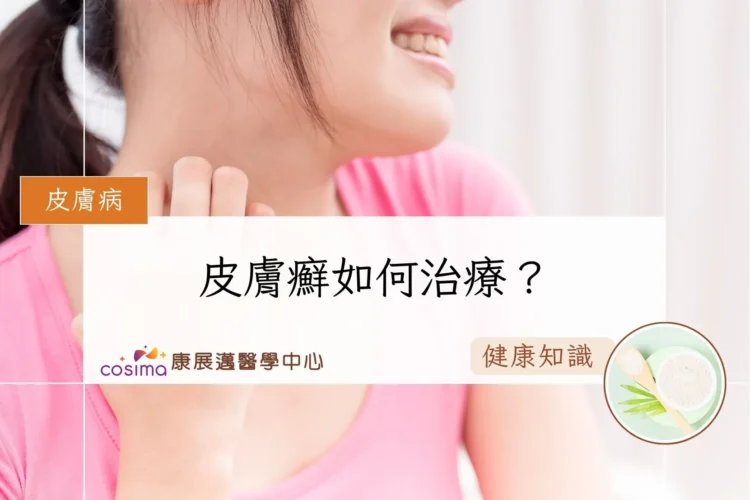 皮膚癬如何治療