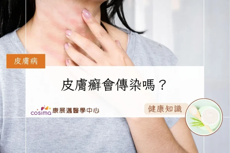 皮膚癬會傳染嗎