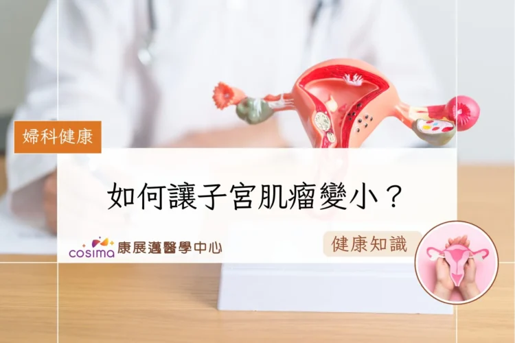 如何讓子宮肌瘤變小？