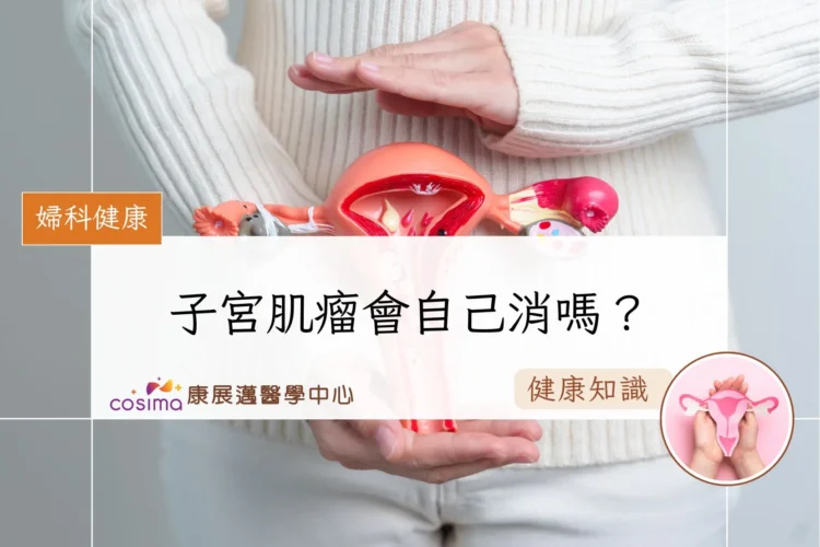 子宮肌瘤會自己消嗎？
