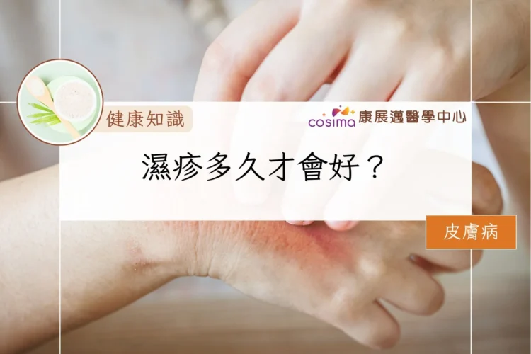 濕疹多久才會好？