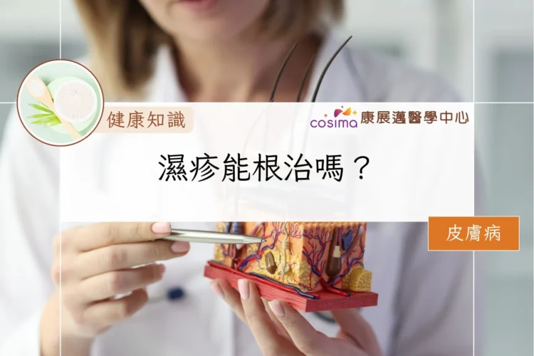 濕疹能根治嗎？