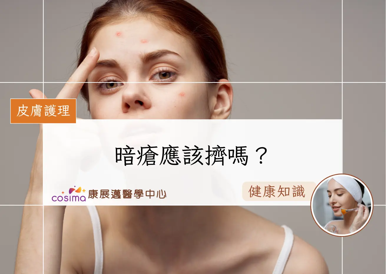 暗瘡應該擠嗎？ - COSIMA 康展邁醫學中心