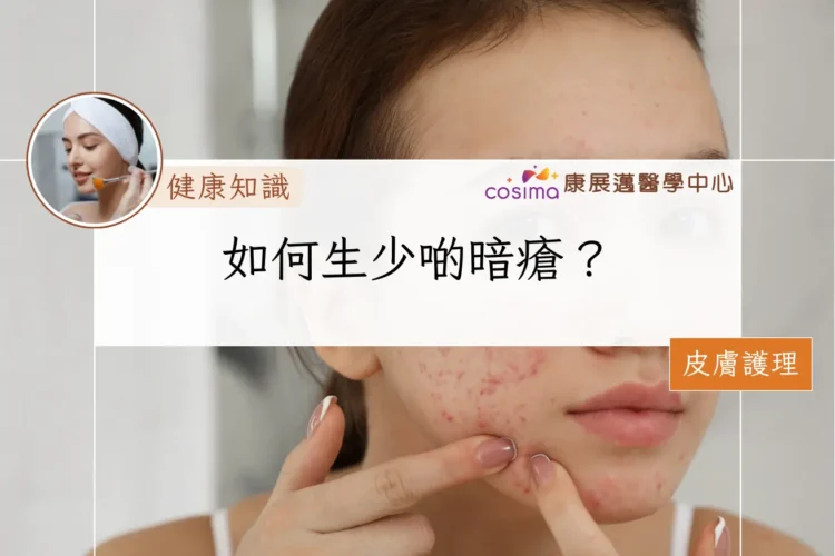 如何生少啲暗瘡