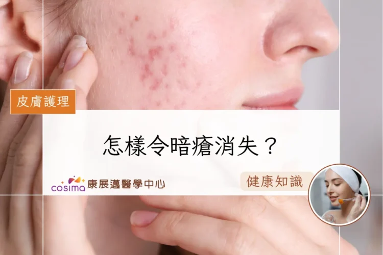怎樣令暗瘡消失