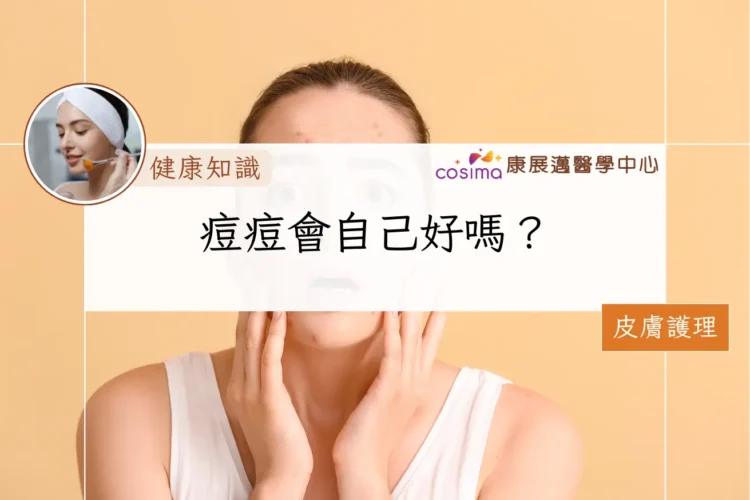 痘痘會自己好嗎