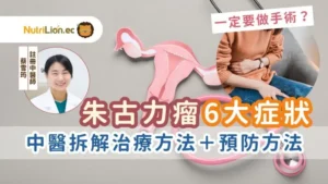 朱古力瘤症狀-中醫婦科-朱古力瘤治療